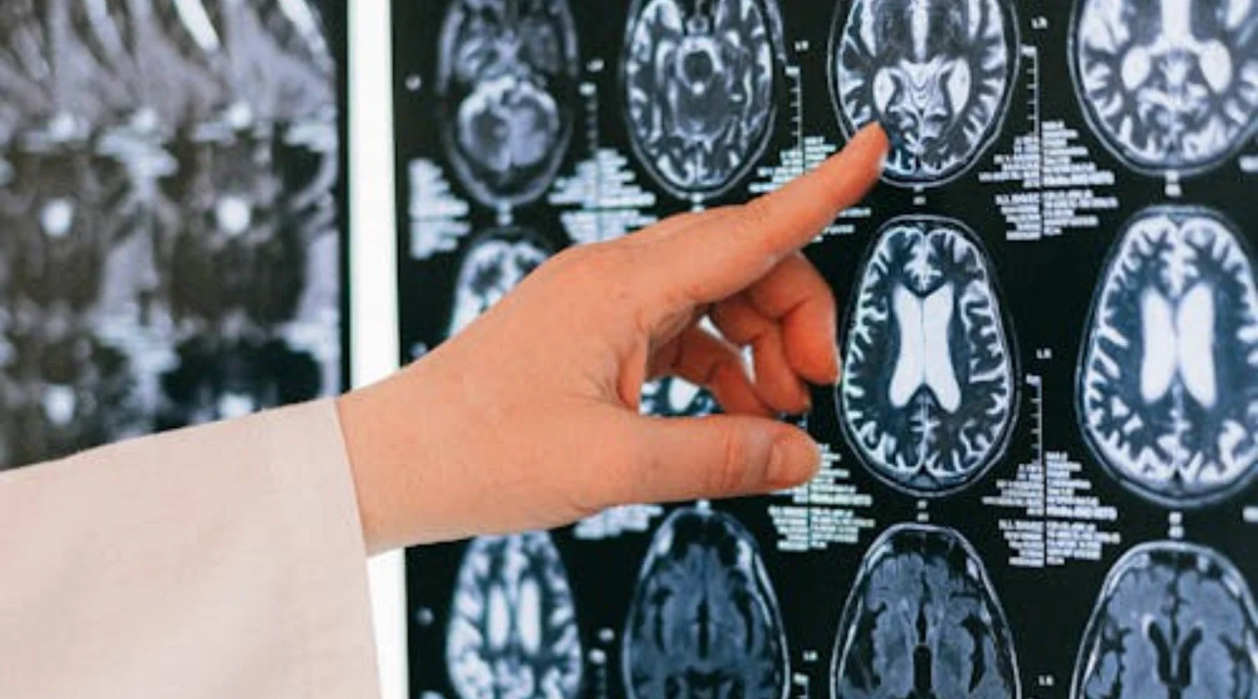 Did You Know Menstrual Blood Might Help Treat Alzheimer's?
