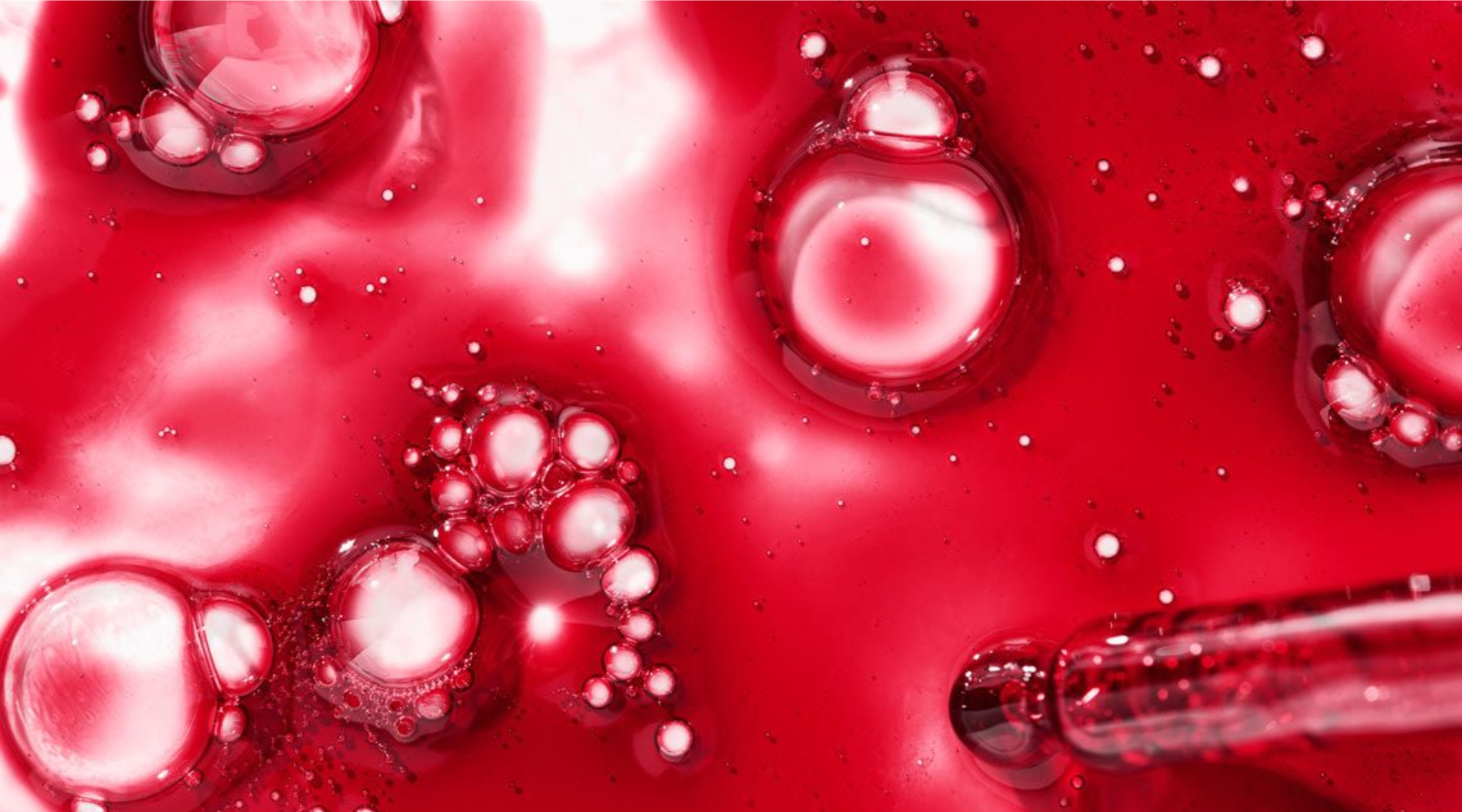 Unraveling PCOS: How It Affects Your Menstrual Cycle